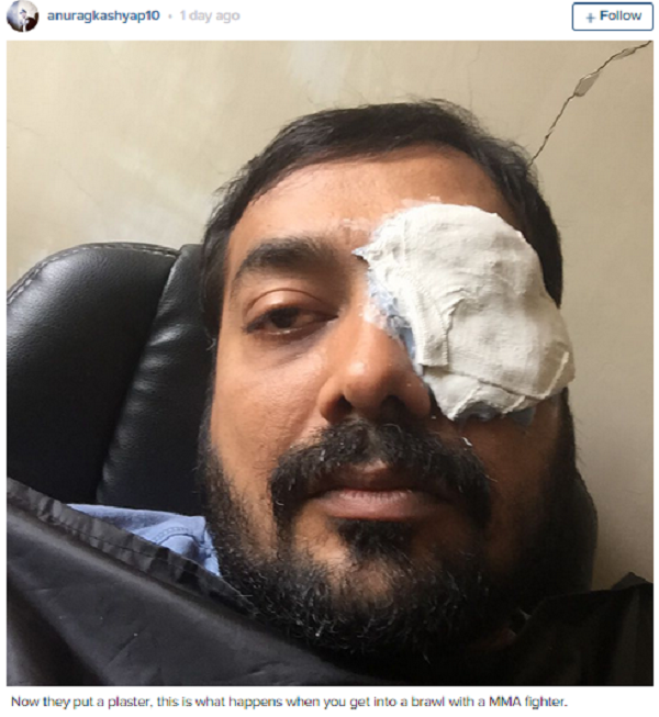 Anurag Kashyap Trolls Indian Media With Fake Accident News & Manages To Make A Point