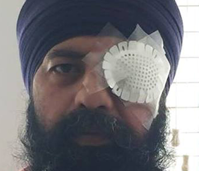 Sikh-American Brutally Assaulted, Turban Knocked Off, Hair Cut With Knife In Alleged Hate Crime