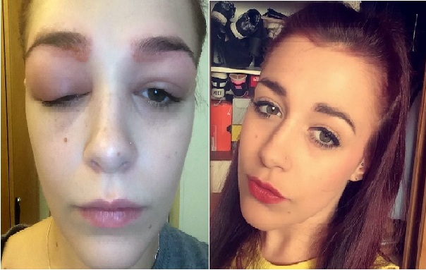 She Wanted Prettier Eyebrows. She Ended Up Doing This To Her Face Instead