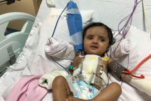 Four-Month-Old Which Encountered 20 Cardiovascular system Assaults Is run through Rare Surgical procedures Throughout Mumbai.