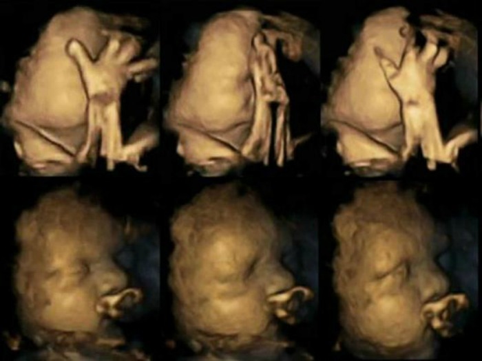4D Ultrasound Research Reveals The Harmful Effects Of Smoking On Unborn Babies