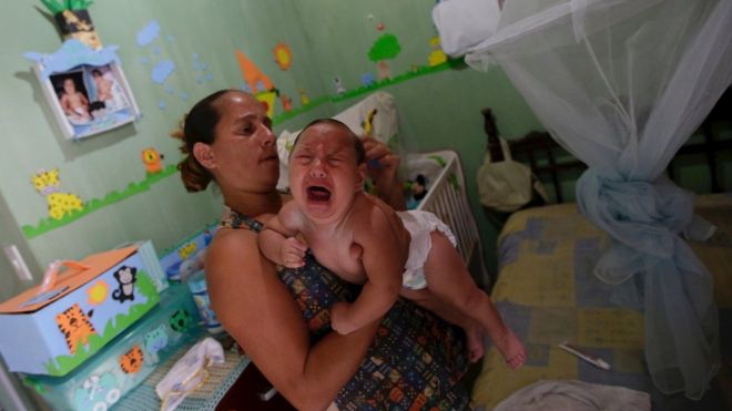 It is Finally Confirmed That Zika Virus Causes Microcephaly and Other Severe Birth Defects