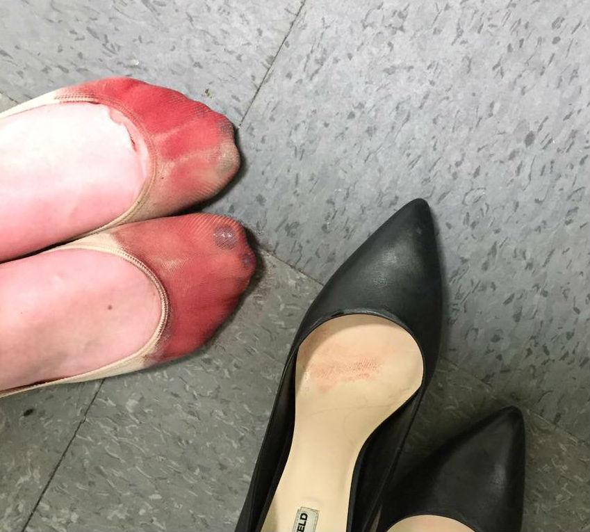 Waitress Shares Pics Of Bleeding Feet After She Was Forced To Wear Heels While Working